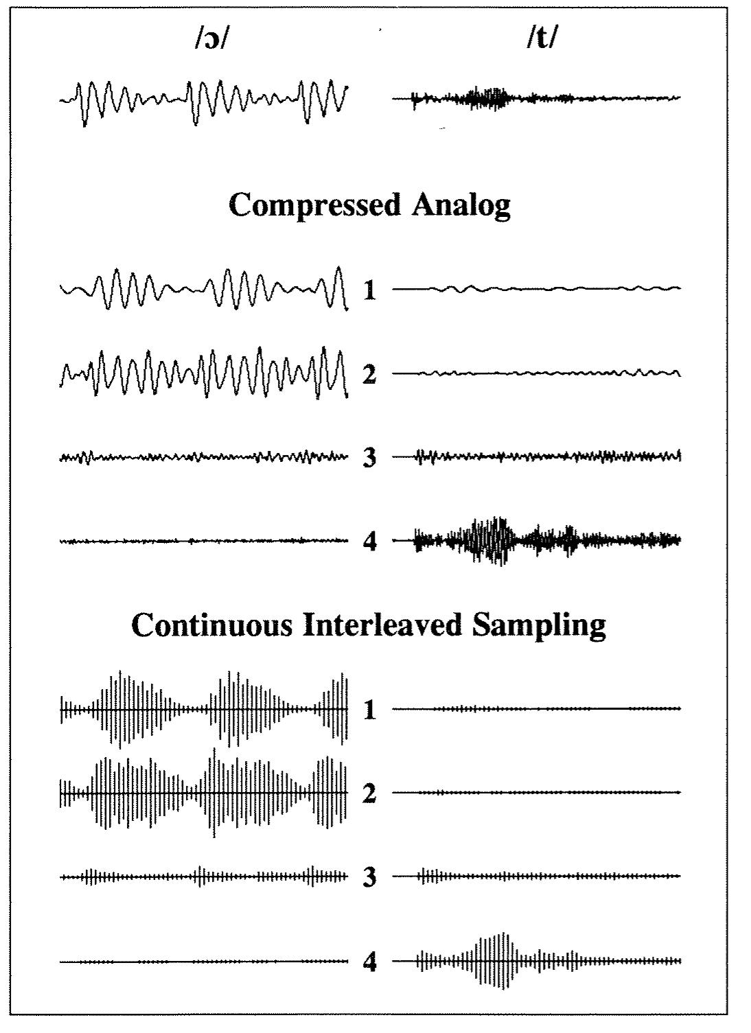 (PDF) Design and evaluation of a continuous interleaved sampling (CIS ...
