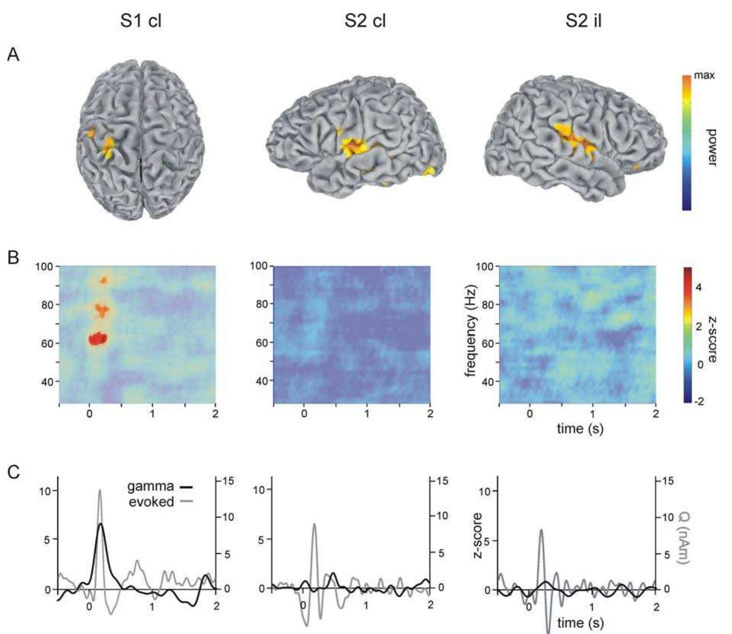(PDF) Gamma Oscillations in Human Primary Somatosensory Cortex Reflect ...