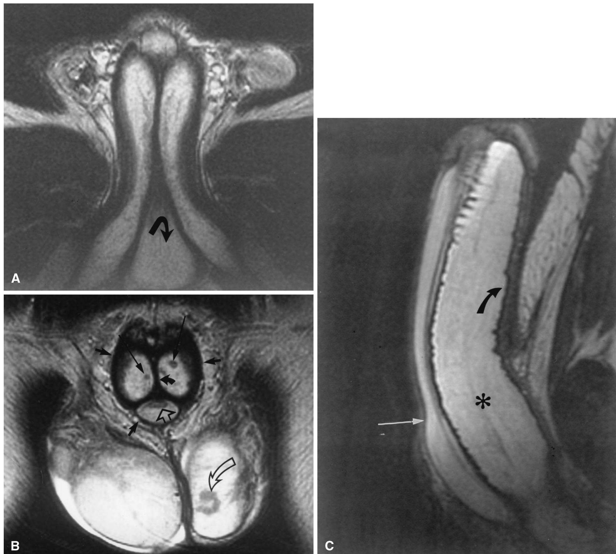 (PDF) Magnetic resonance imaging of the penis