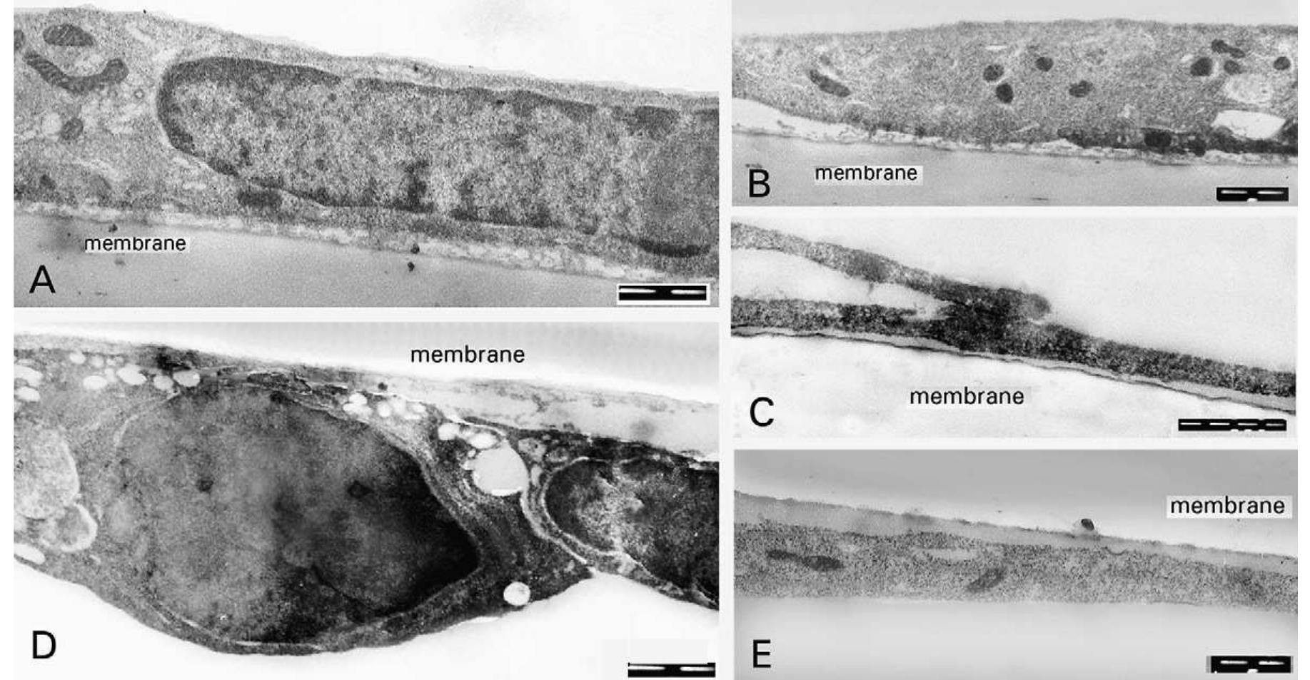 Figure 4 - from A new blood–brain barrier model using