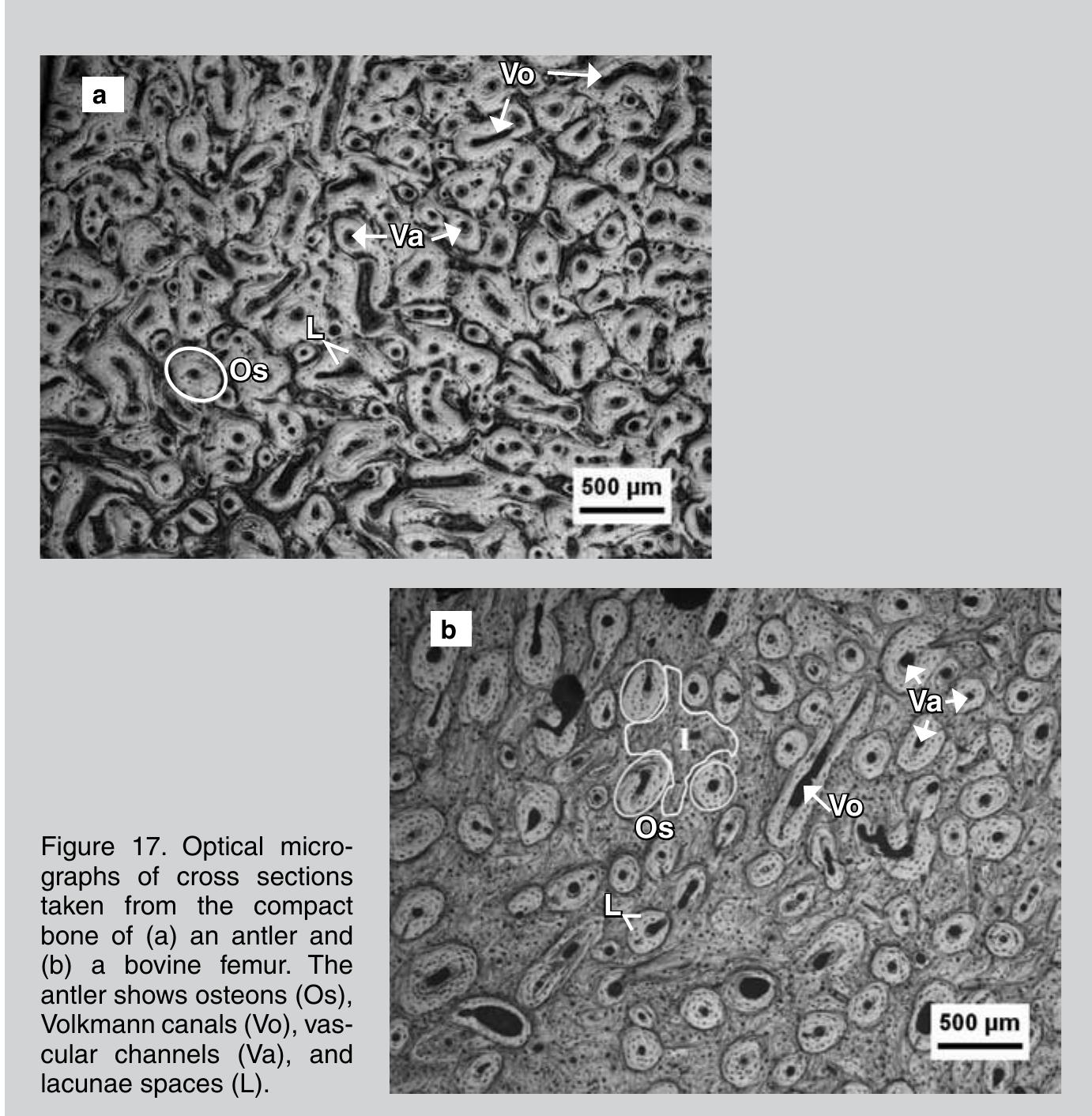 Two types of osteons can be present in bone: primary and