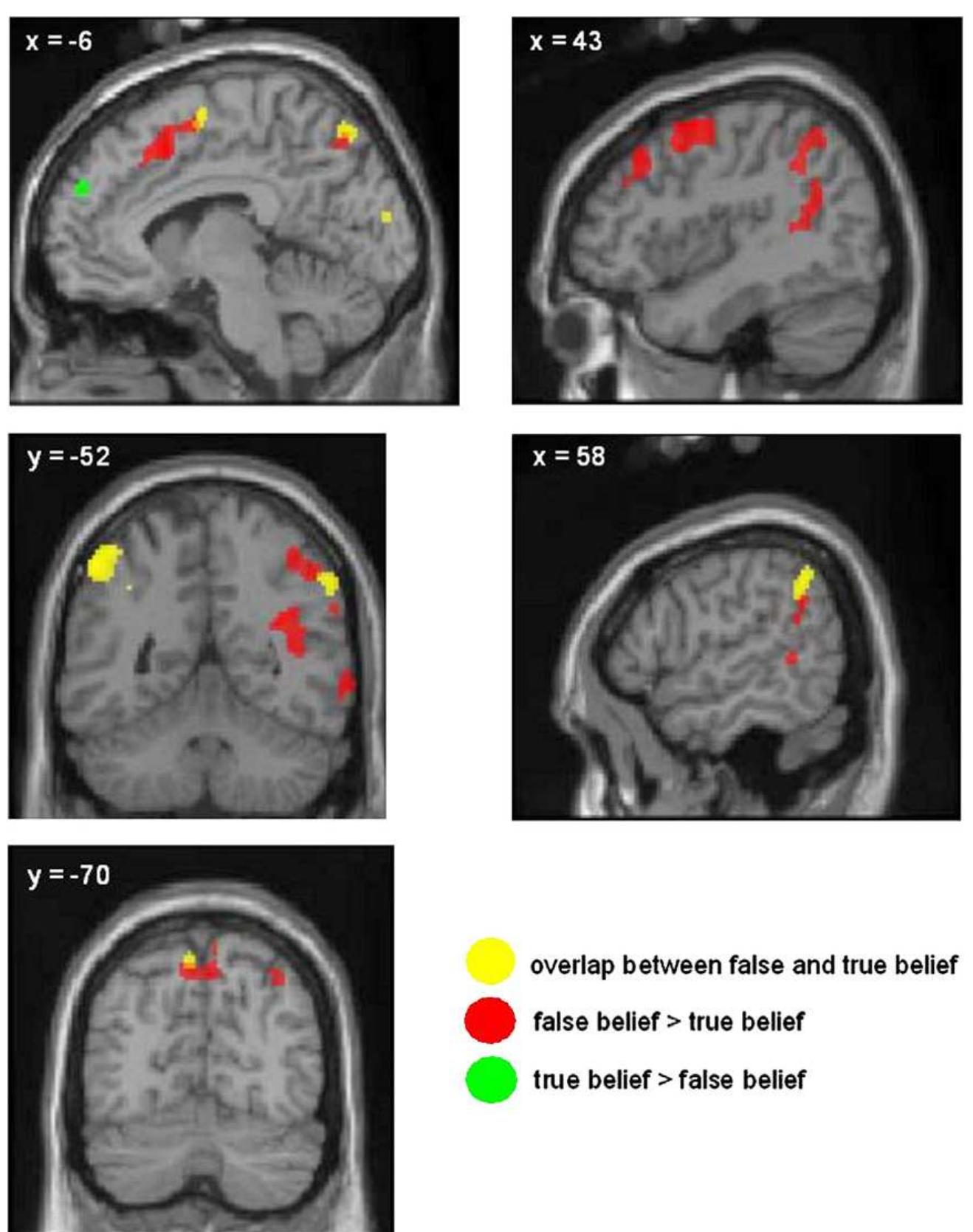 (PDF) Neural correlates of true and false belief reasoning