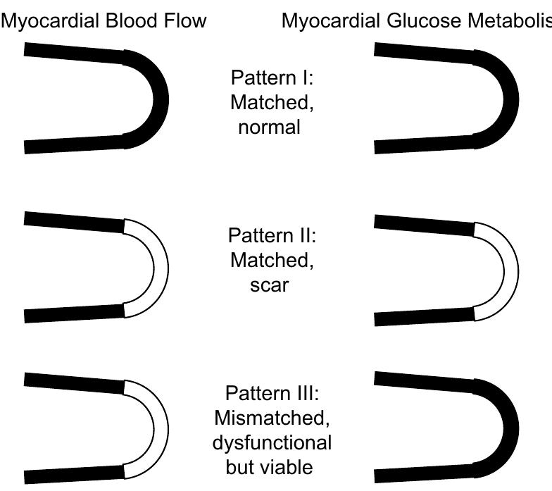 Schematic depicting patterns of myocardial blood flow and