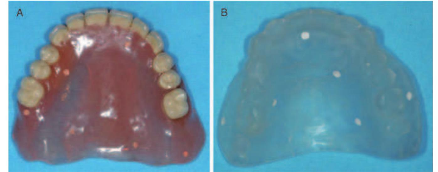 Figure 1 - from Prosthetically Driven, Computer-Guided