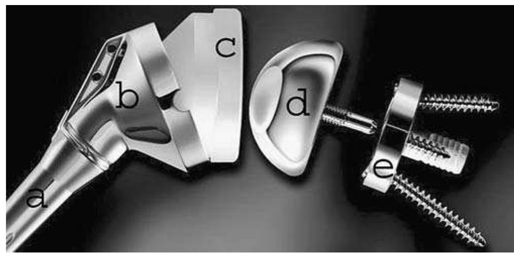 (PDF) The reverse shoulder prosthesis: a review of imaging features and ...