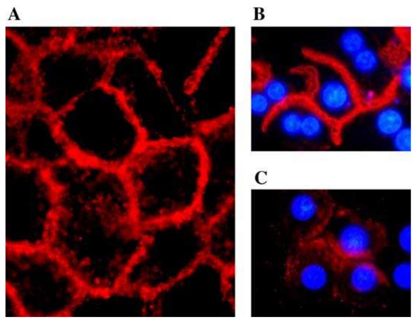(PDF) Shared apical sorting of anion exchanger isoforms AE2a, AE2b1 ...