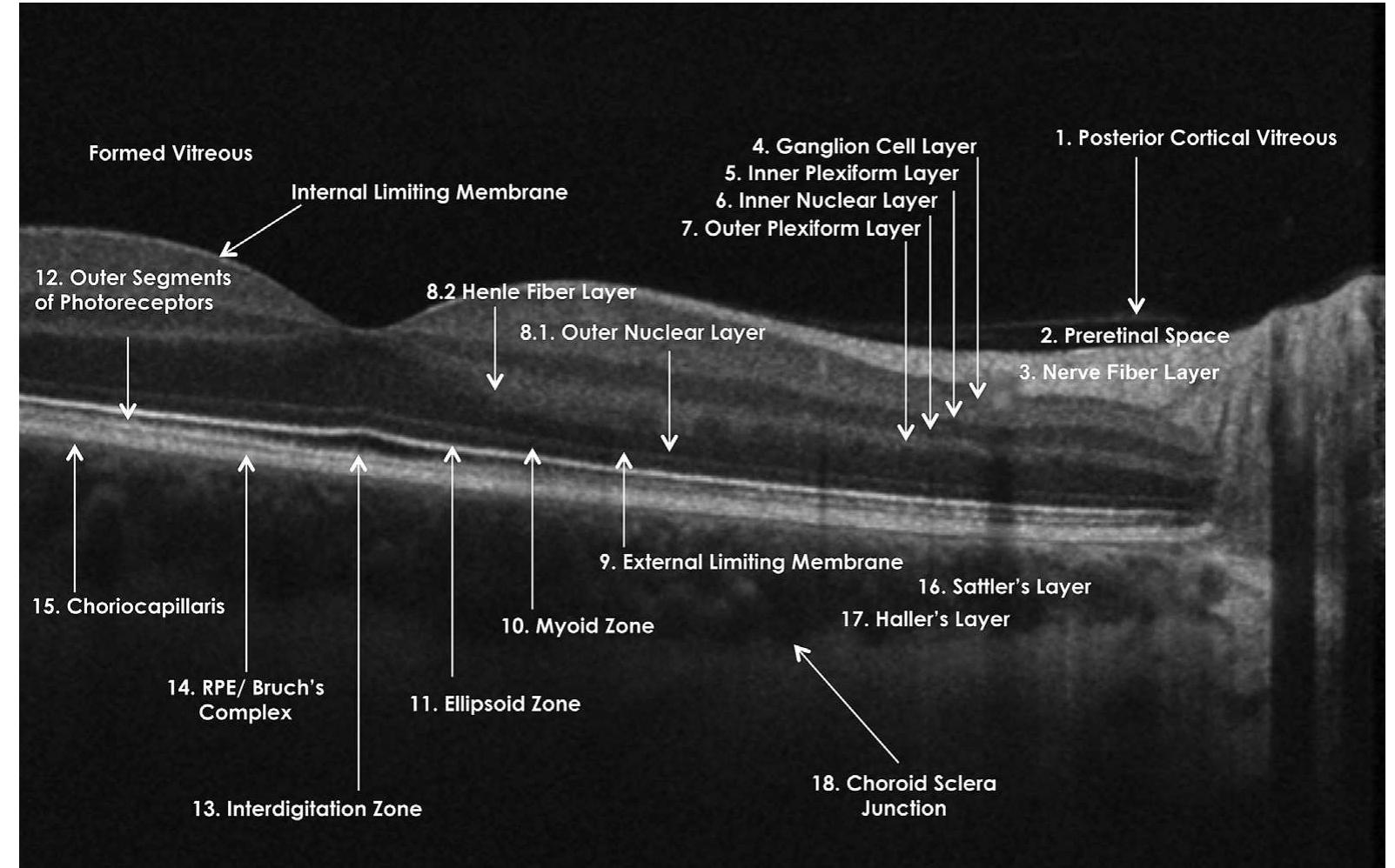 List of optical coherence tomography layers as agreed on by
