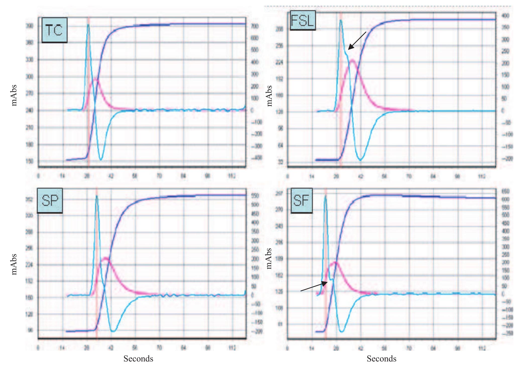 (PDF) A study of atypical APTT derivative curves on the ACL TOP ...