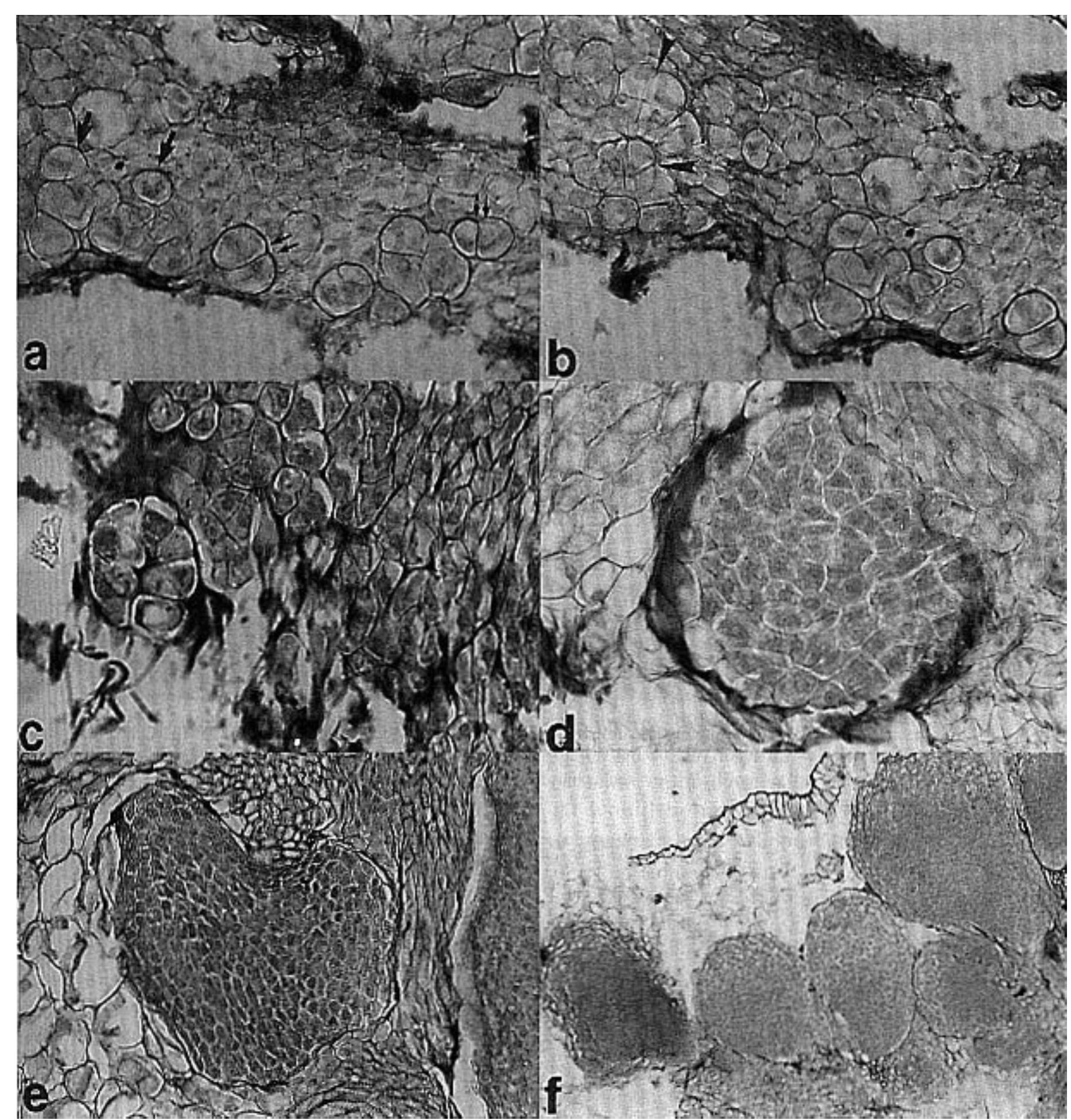 4. origin of embryoids in embryo-derived callus culture. (a)