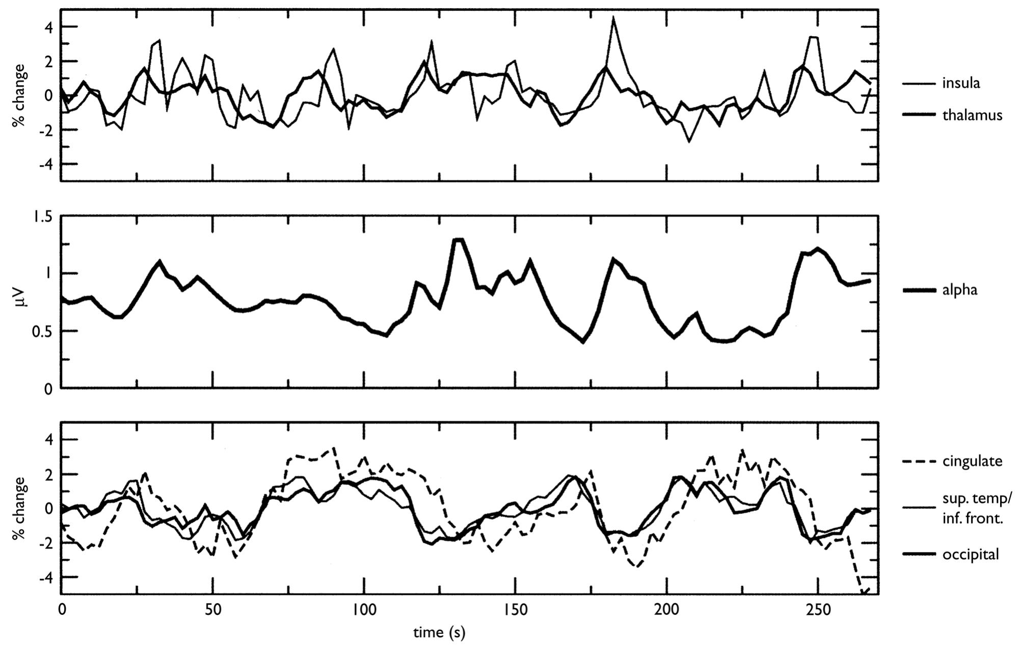 (PDF) Simultaneous EEG and fMRI of the alpha rhythm