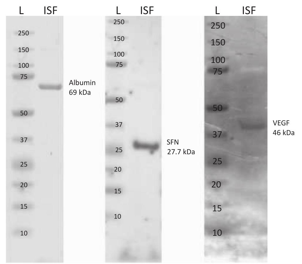 (PDF) A modified method using the SonoPrep ® ultrasonic skin permeation ...