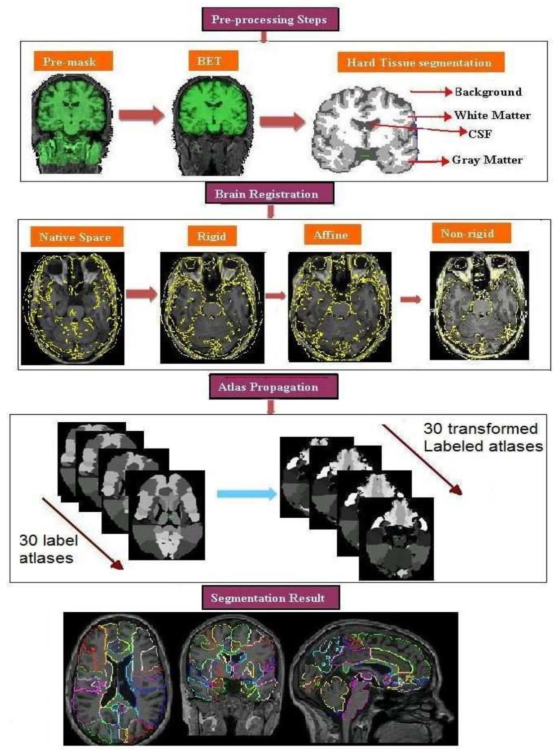 (PDF) Automatic segmentation of brain MRIs and mapping neuroanatomy ...