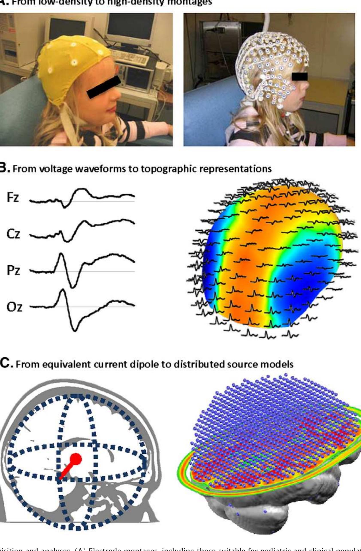 (PDF) Towards the utilization of EEG as a brain imaging tool