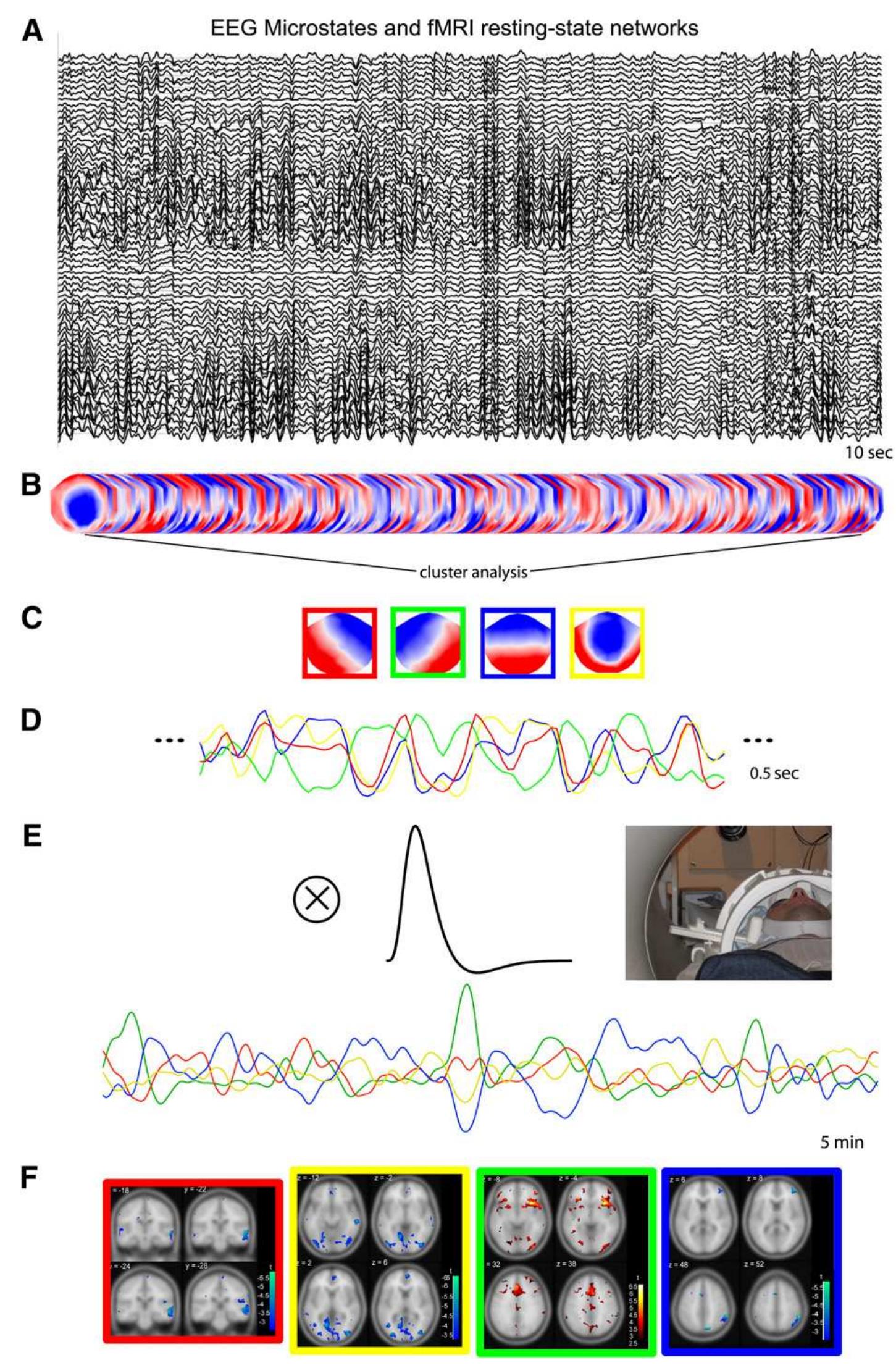 (PDF) Towards the utilization of EEG as a brain imaging tool
