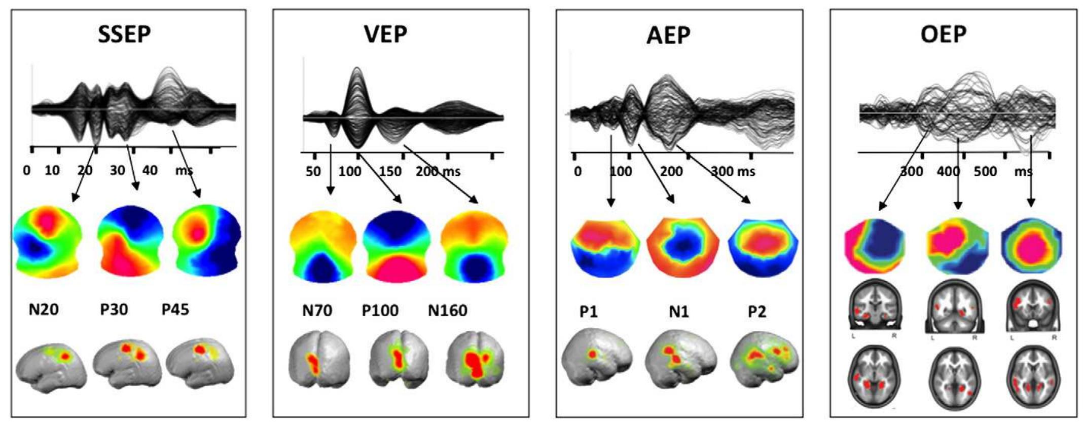 (PDF) Towards the utilization of EEG as a brain imaging tool