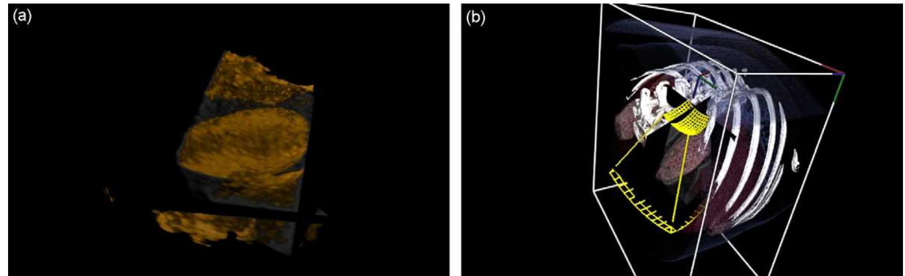 Mpr Volume Rendering (PDF) Visualization and GPU-accelerated simulation of medical ...