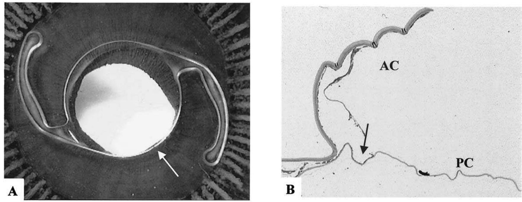 (PDF) Scanning electron microscopic and histologic evaluation of the ...