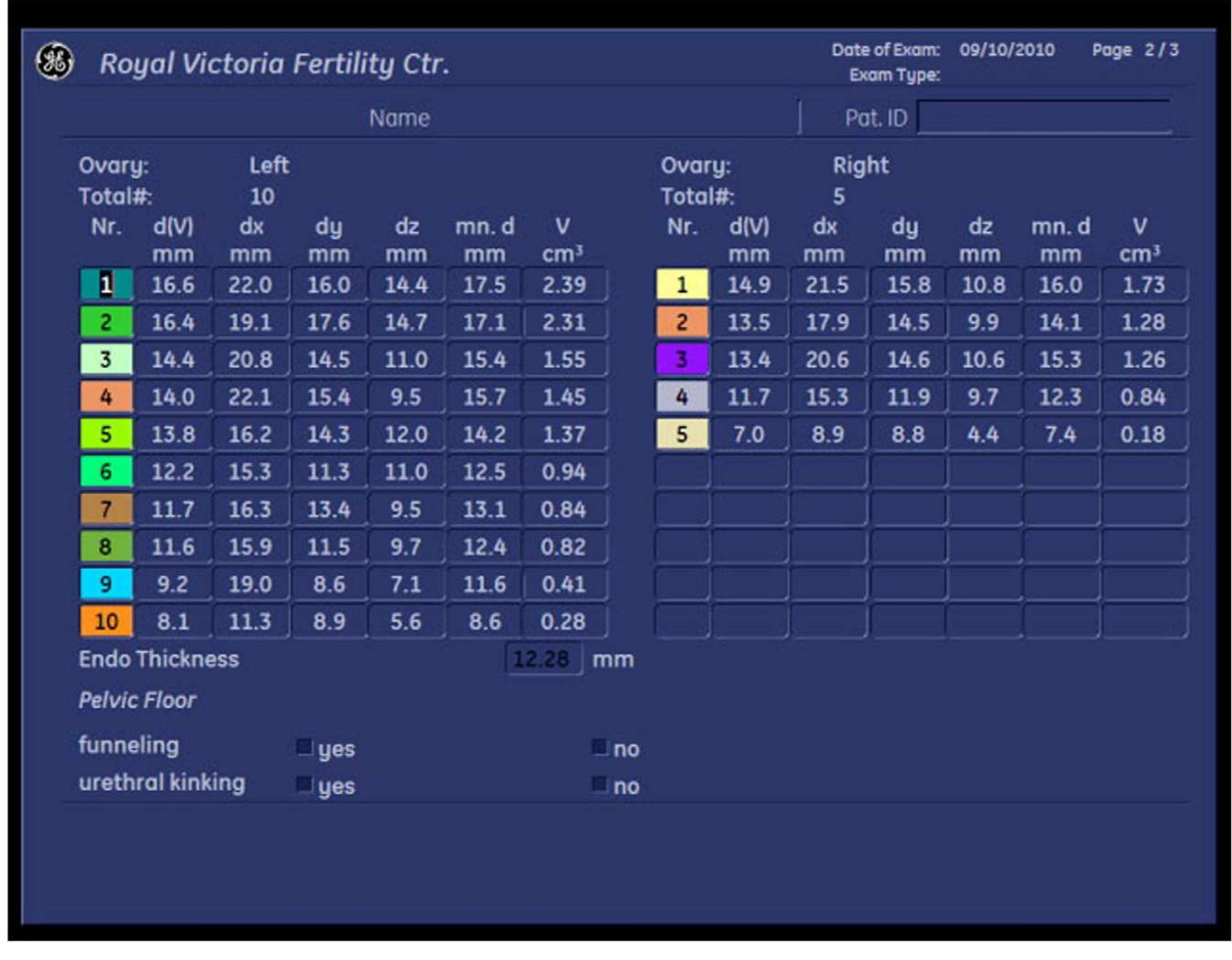 (PDF) Ultrasound automated volume calculation in reproduction and in ...