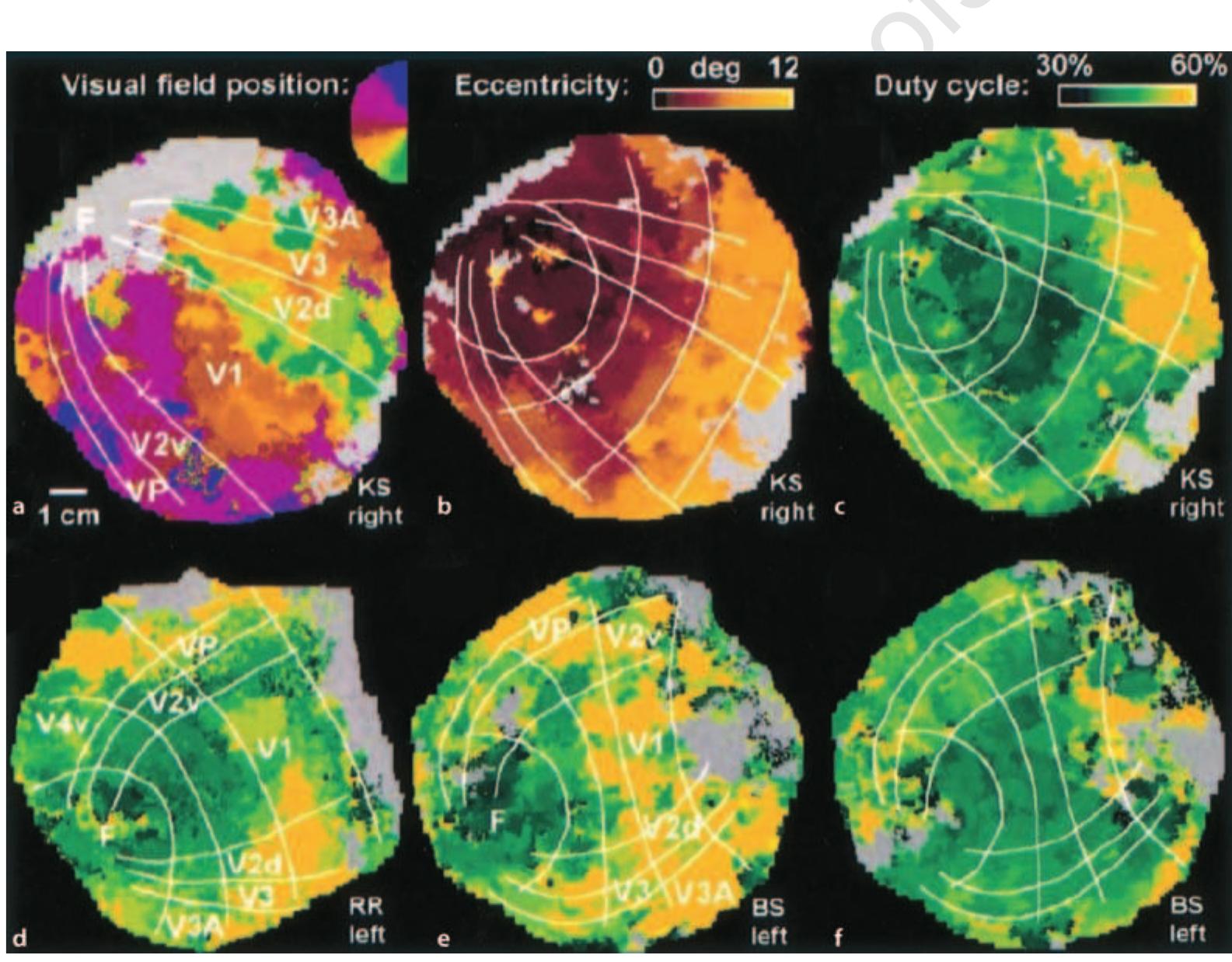 (PDF) Functional neuroanatomy of the human visual system: a review of ...