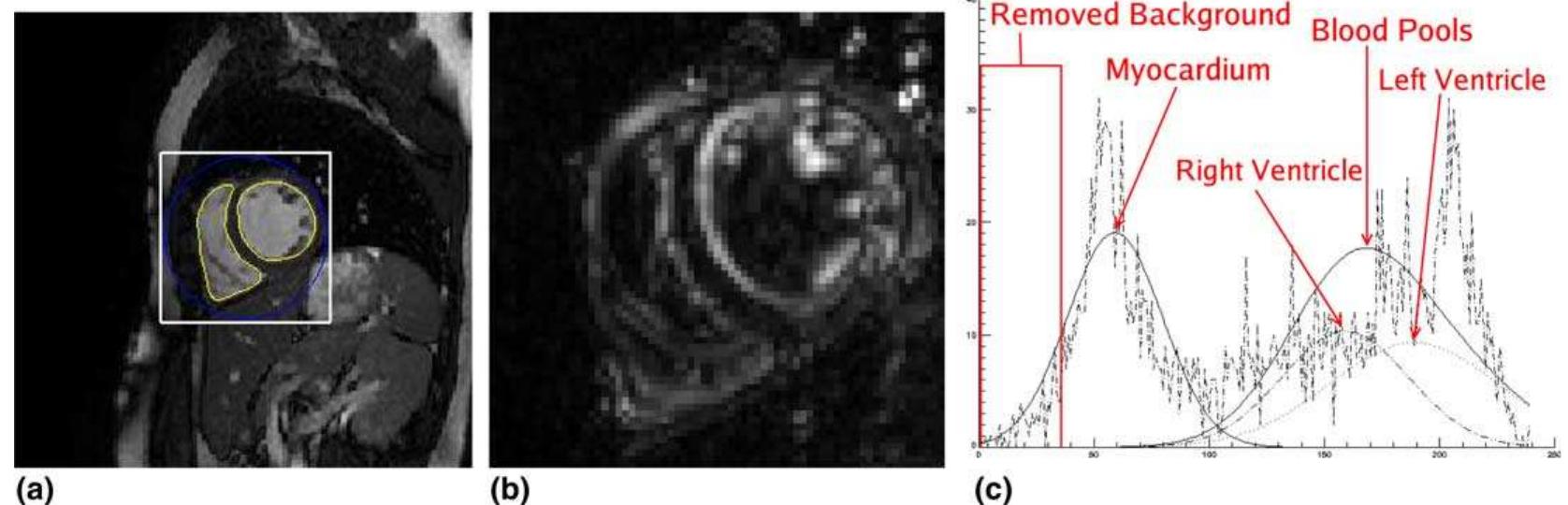 Segmentation of the ventricular blood pools. (a) selection