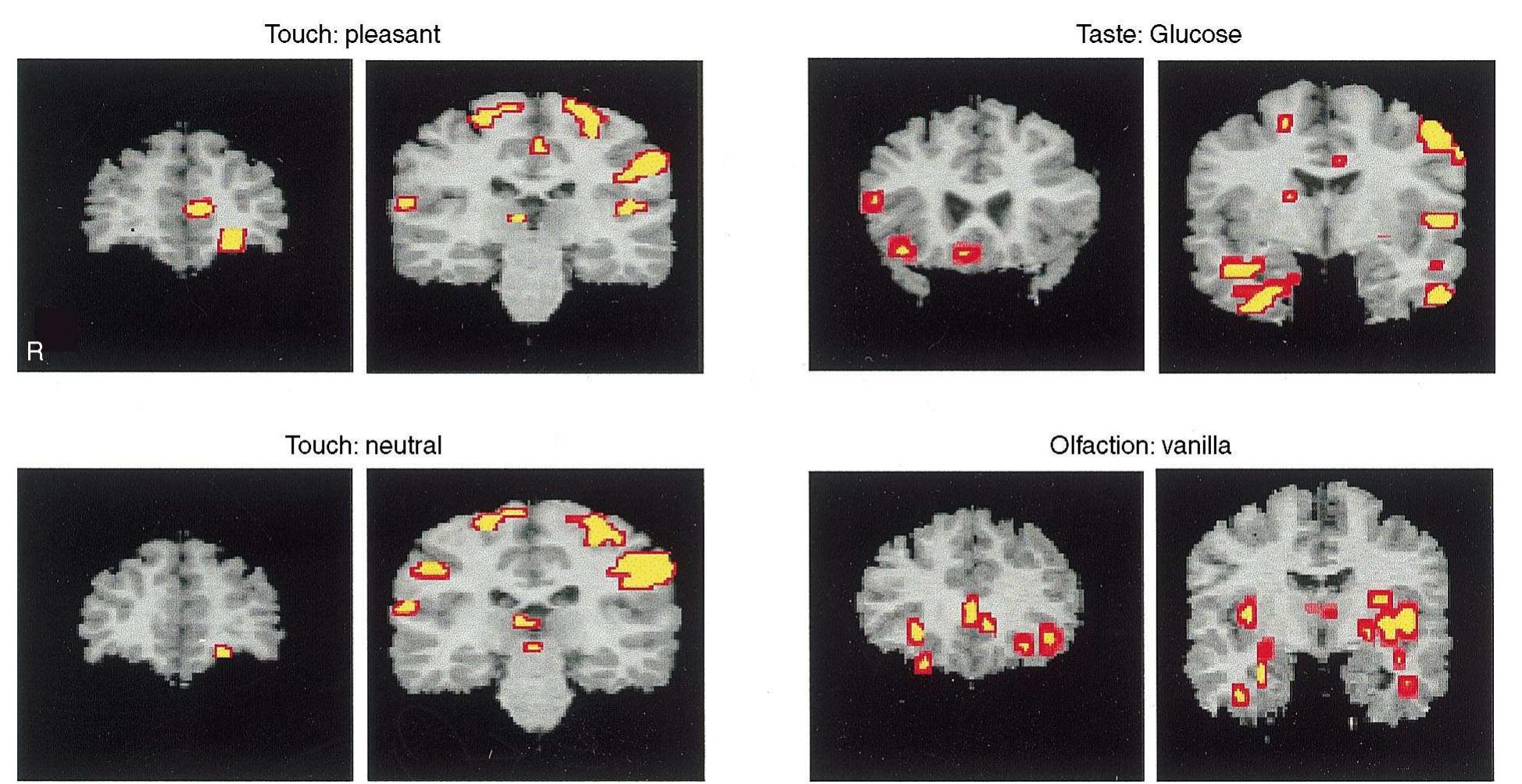 (PDF) The representation of pleasant touch in the brain and its ...