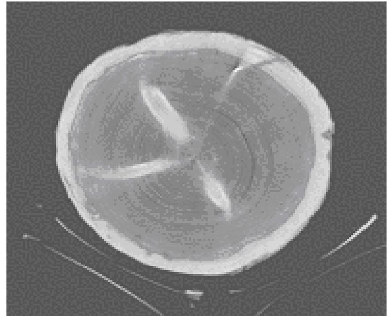 PDF) Automated individual tree measurement through morphological