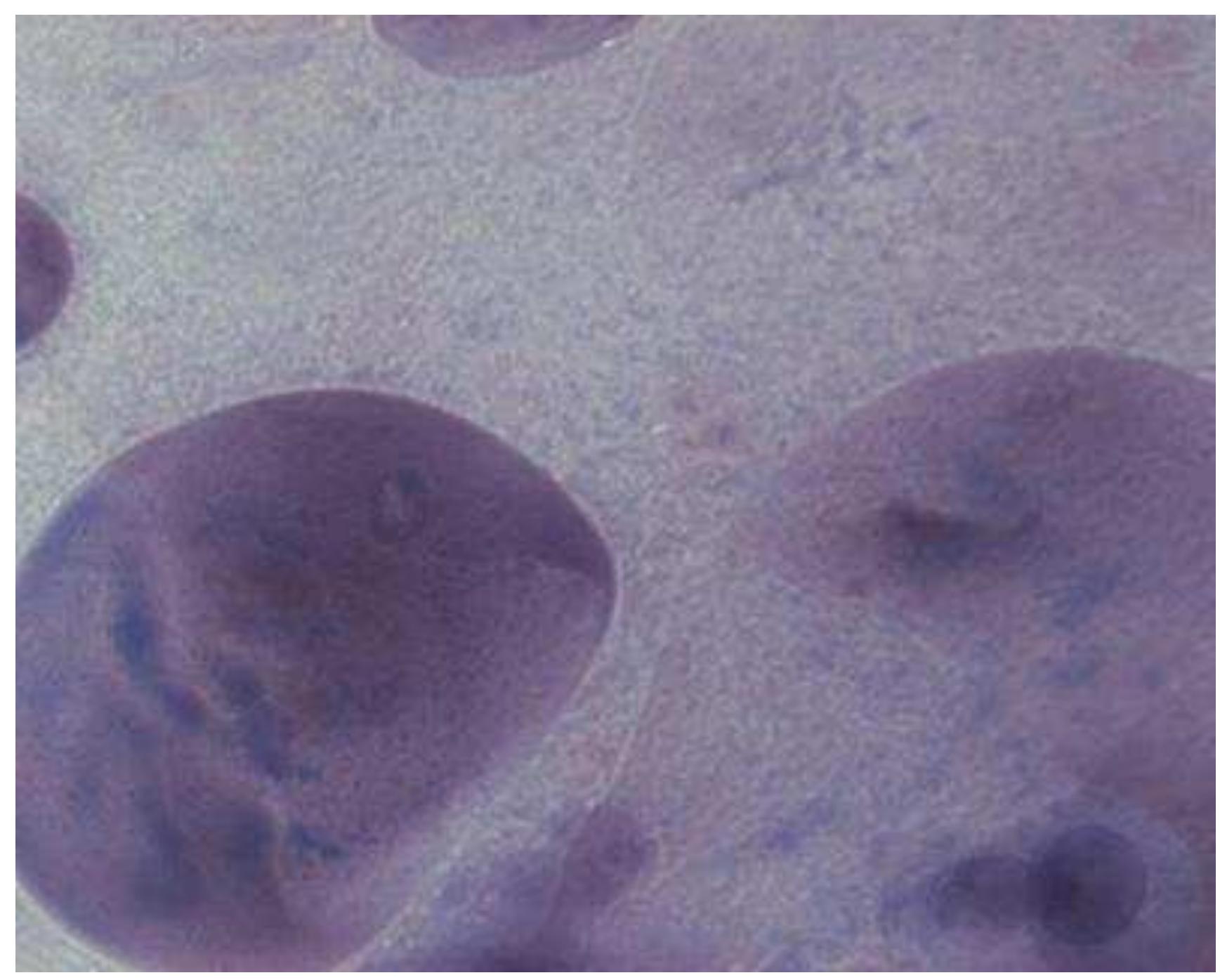 Fig. 6. Light microscopy pictures of starch solutions  a. native potato starch 