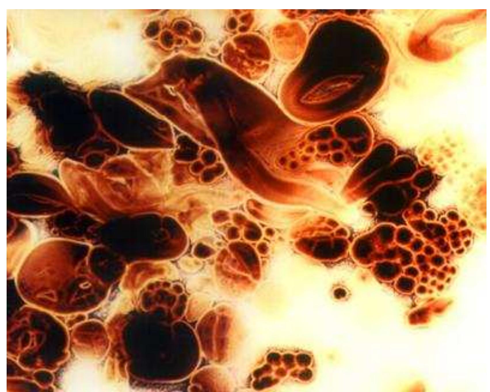 Light microscopy pictures of acetylated starch E 1420 (Fig. 7) represented a quite different  violet complexes of starc the conformation of starc  the case of oxidised starc  the enzymatic action of a with i0dine  h macromolecules probably hindered the en  amylases and caused drop in the digestibility of starch. It could not b  hes, the conformational changes of starch m  h with iodine became impossible. These relatively deep ch  rming standard  zymatic action  acromolecules  mylases, though these changes did not distu  e excluded that,  image in comparison to native and oxidised starches. At the microphotograph of acetylated starch it was impossible to discriminate the amylose and amylopectin fractions. Ne amylose molecules formed the blue complex nor amylopectin the red one. All starch macromolecules created quite different brown complex. This observation seems to be crucial to understand the differences in digestibility of modified starches. Modifying acety changed the conformation of starch macromolecules so much that fo  ither  groups blue and anges in of  hindered  rb forming complexes 