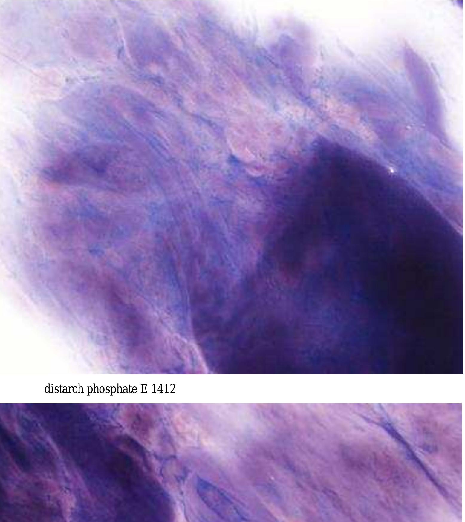 Fig. 8. Light microscopy pictures of cross-linked starch solutions: a — distarch phosphate E 1412; b — acetylated distarch phosphate E 1414; c— acetylated distarch adipate E 1422  acetylated distarch phosphate E 1414 