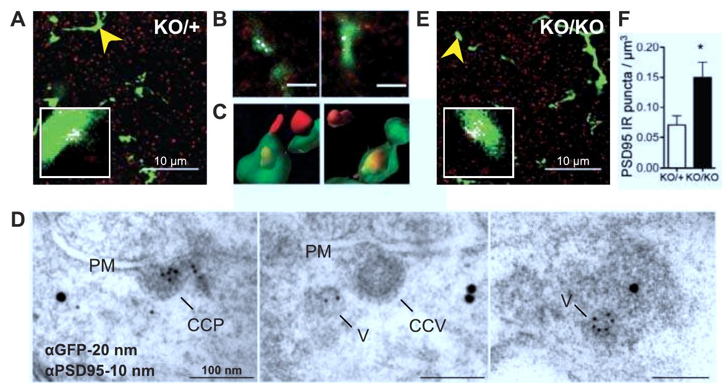 (PDF) Synaptic Pruning by Microglia Is Necessary for Normal Brain ...