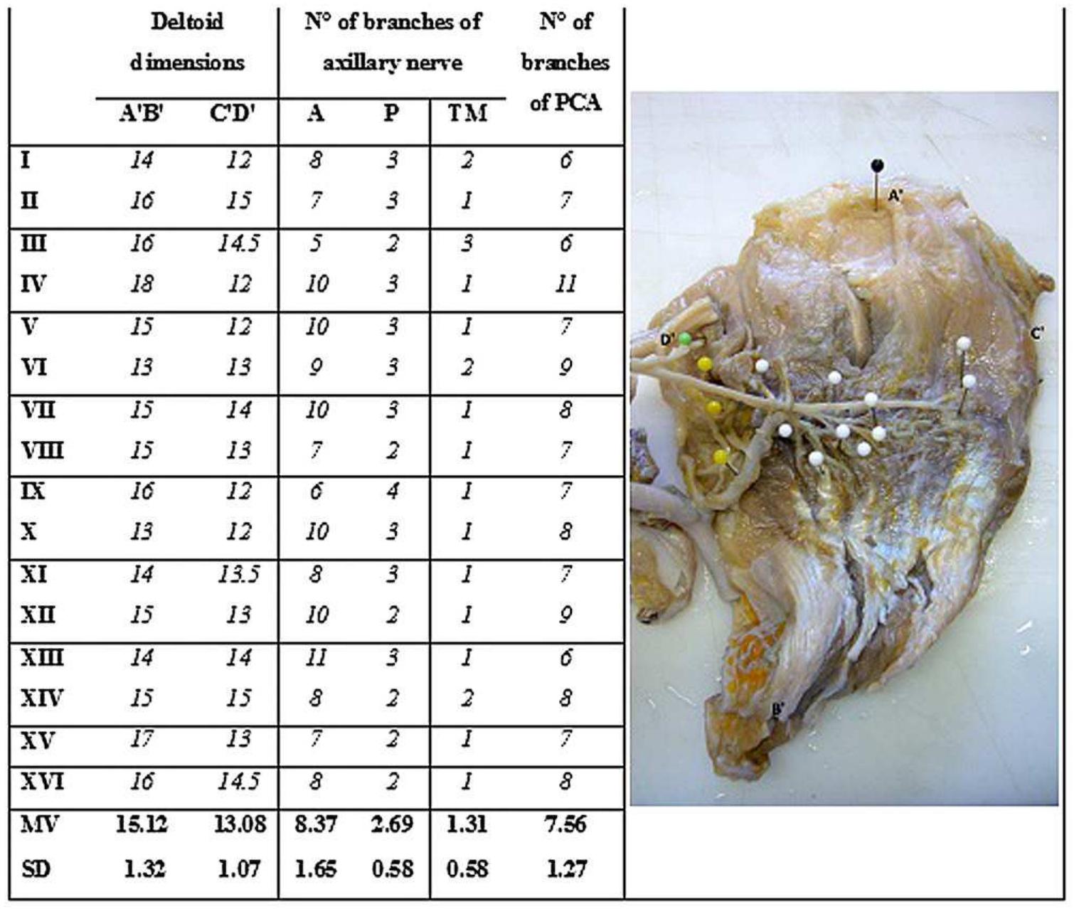 Table 1 - from Surgical anatomy of the axillary nerve and