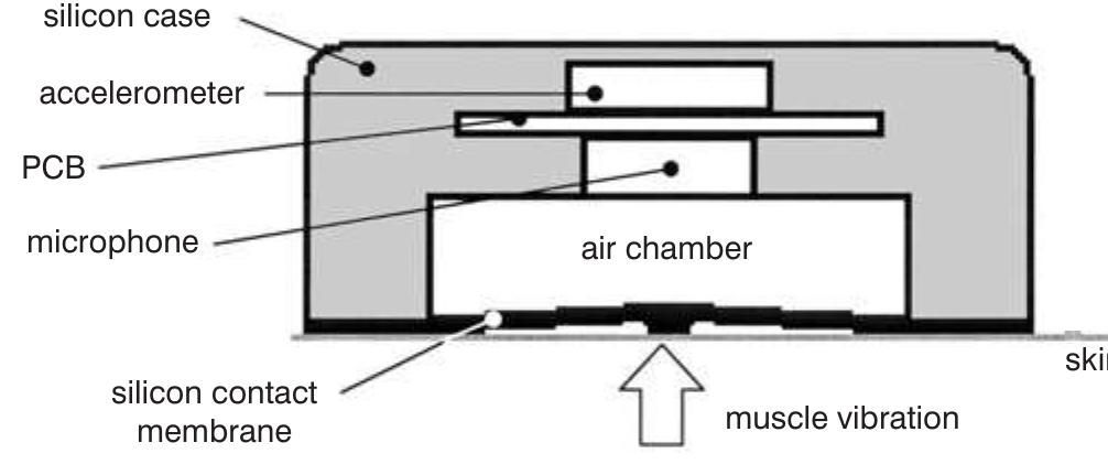 (PDF) Coupled microphone-accelerometer sensor pair for dynamic noise ...