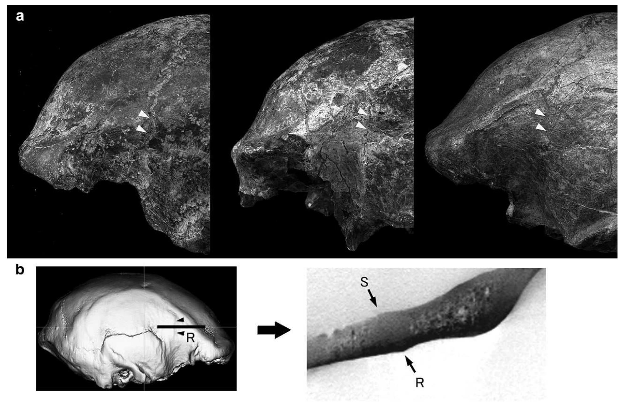 (PDF) Cranial morphology of Javanese Homo erectus: New evidence for ...
