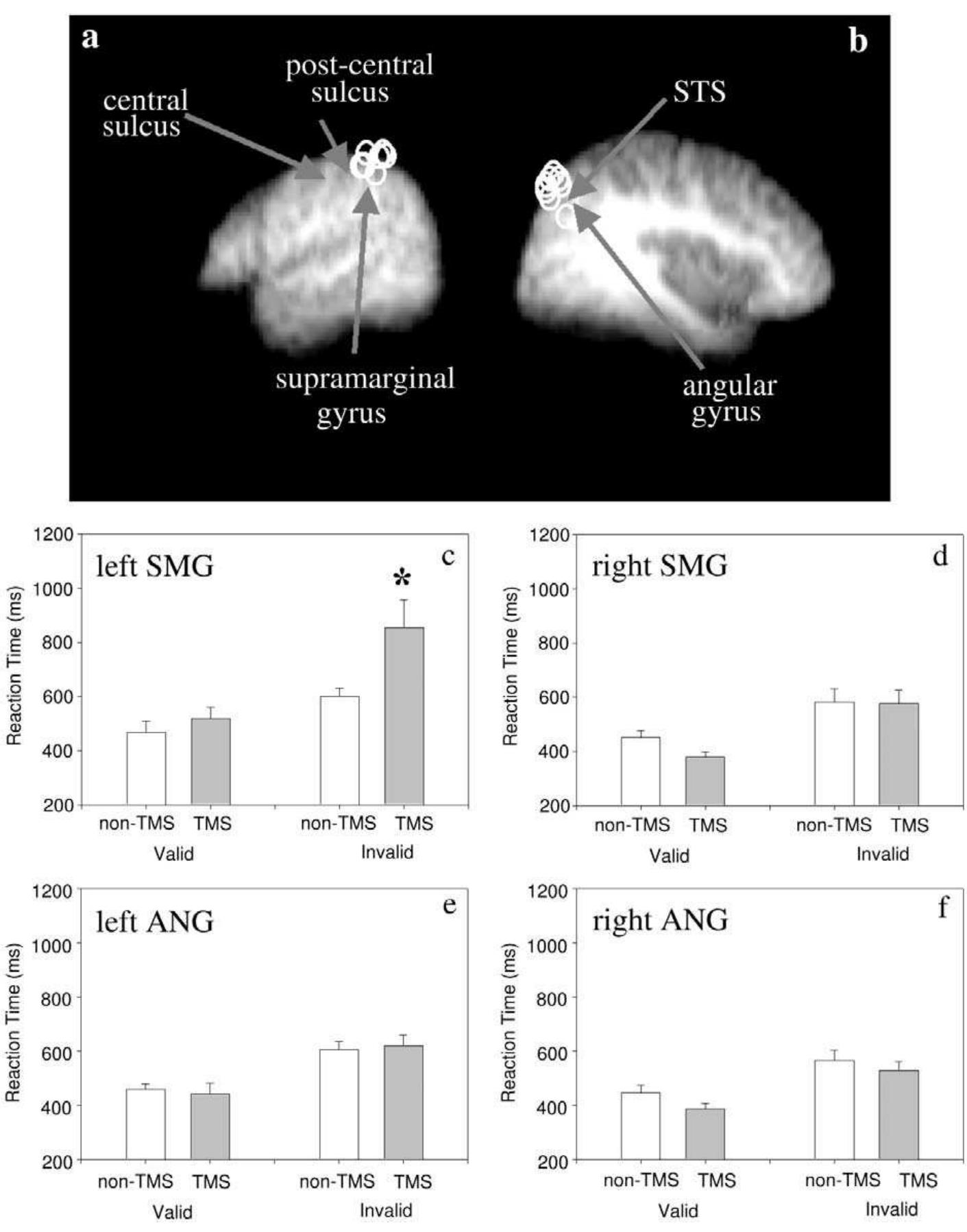 (PDF) The left parietal and premotor cortices: Motor attention and ...