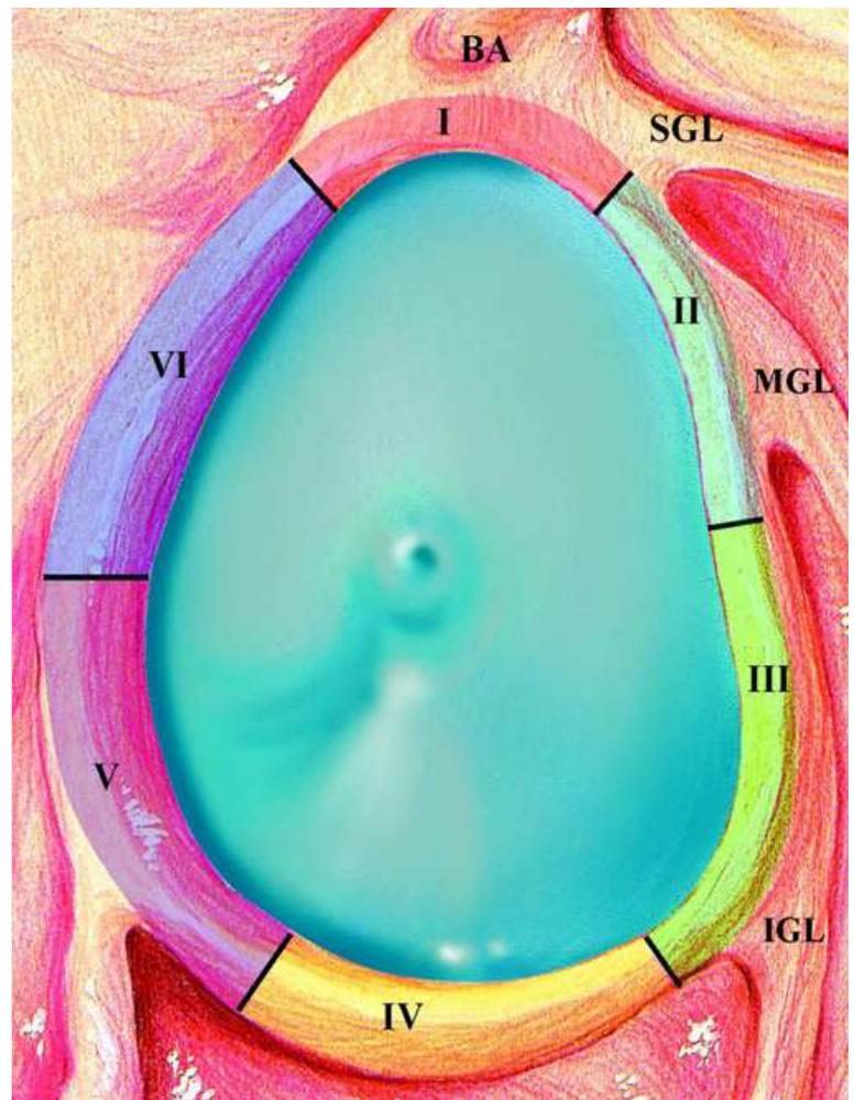 Tear of the inferior labrum anterior and posterior. indirect