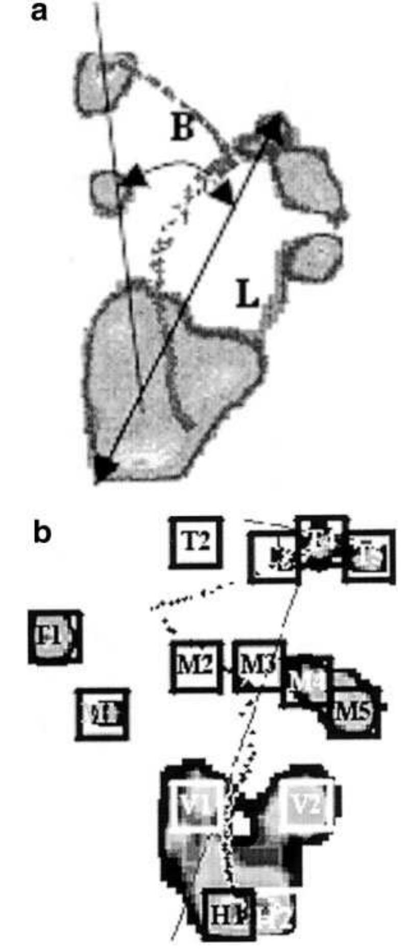 Examples of roll-off patterns of left foot during qua-