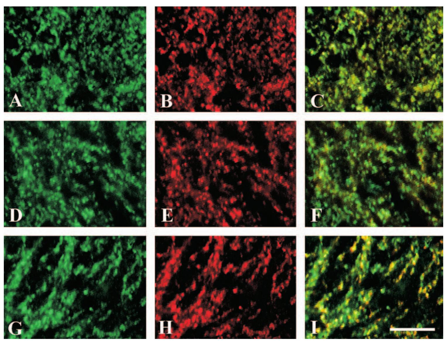(PDF) Extensive nuclear localization of α-synuclein in normal rat brain ...