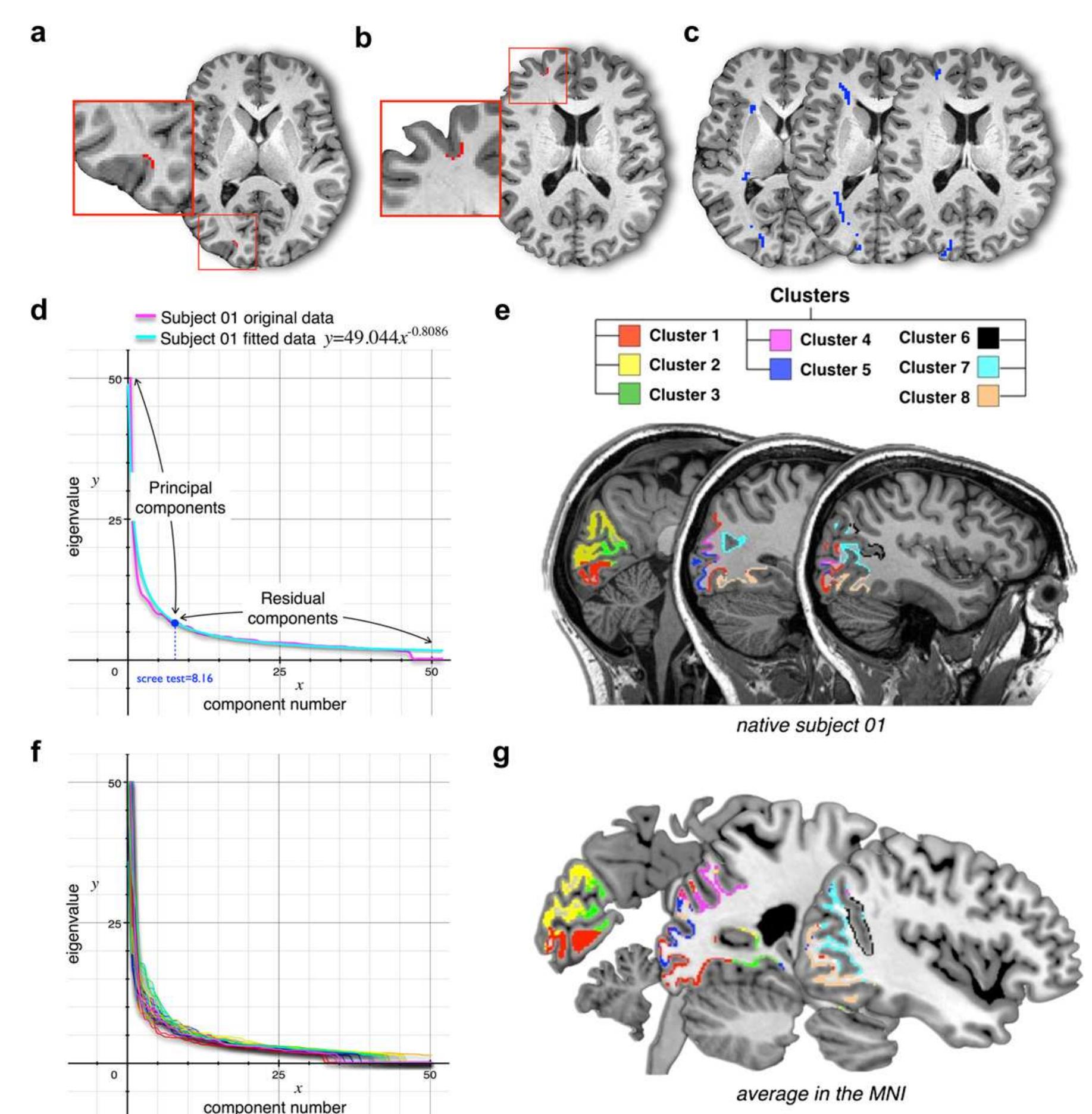 (PDF) Subdivision of the occipital lobes: An anatomical and functional ...