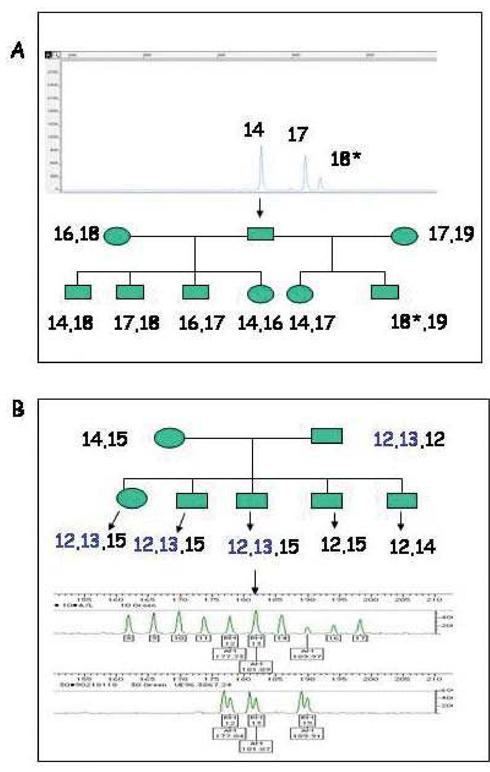 Triallele Pattern (PDF) A Genetic Basis for Anomalous Band Patterns Encountered During ...