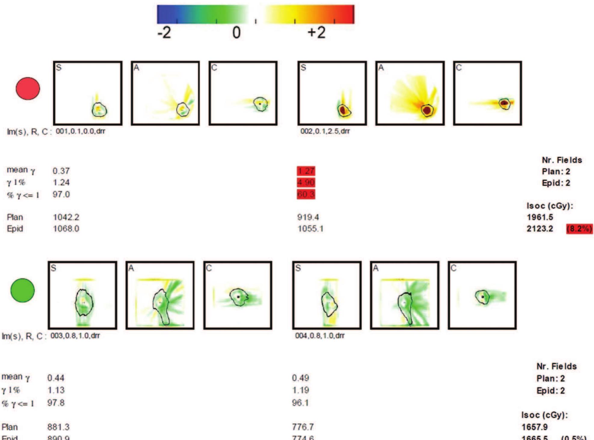 (PDF) In vivo dosimetry during external photon beam radiotherapy