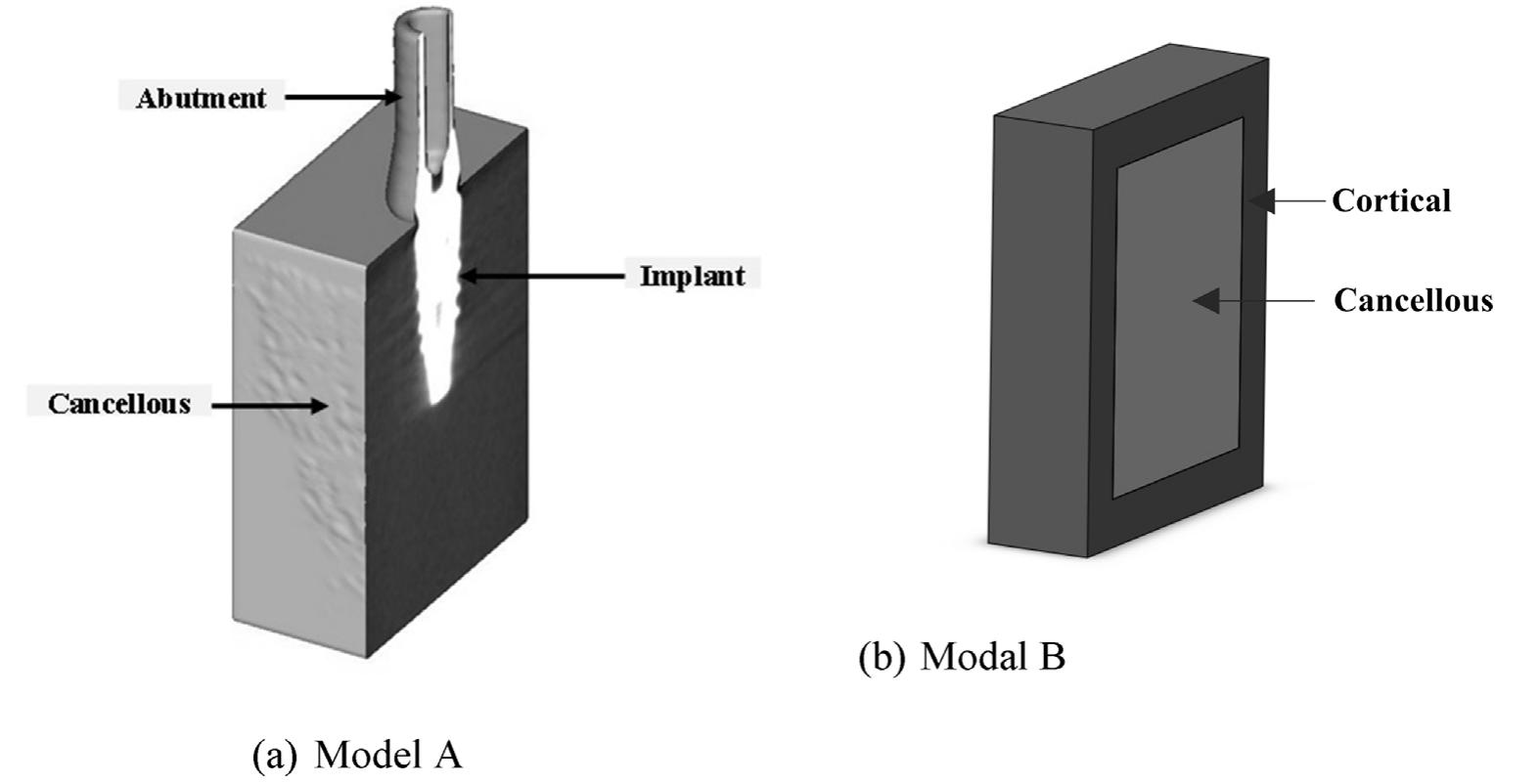 Figure 7 - from The effects of implant angulation on the
