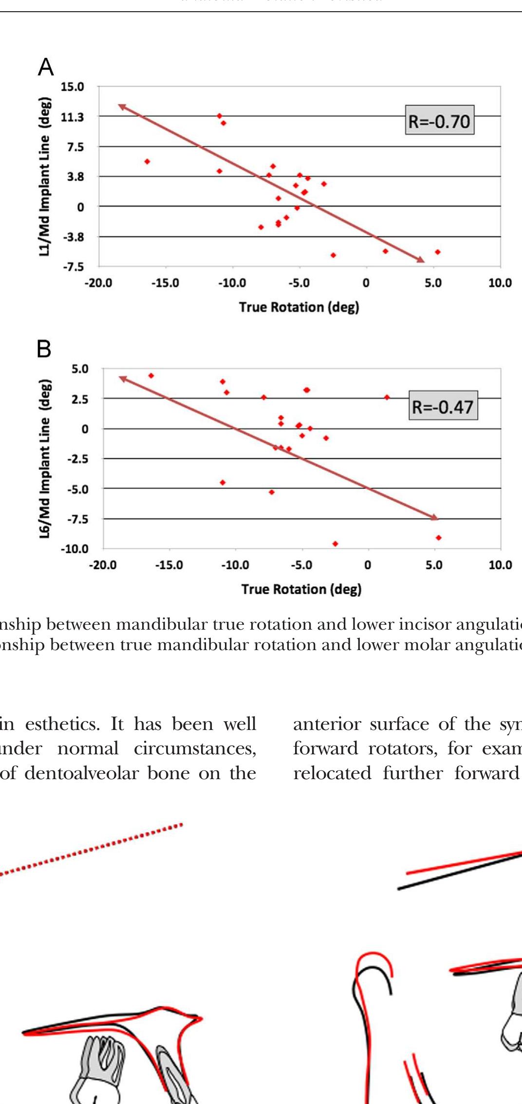 Figure 18 - Mandibular rotation revisited: What makes it so