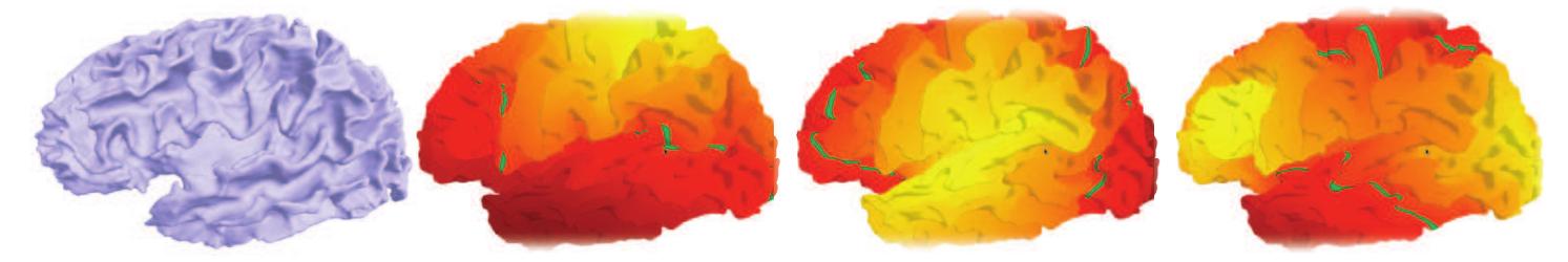 Left cerebral cortex and first eigenfunctions of the