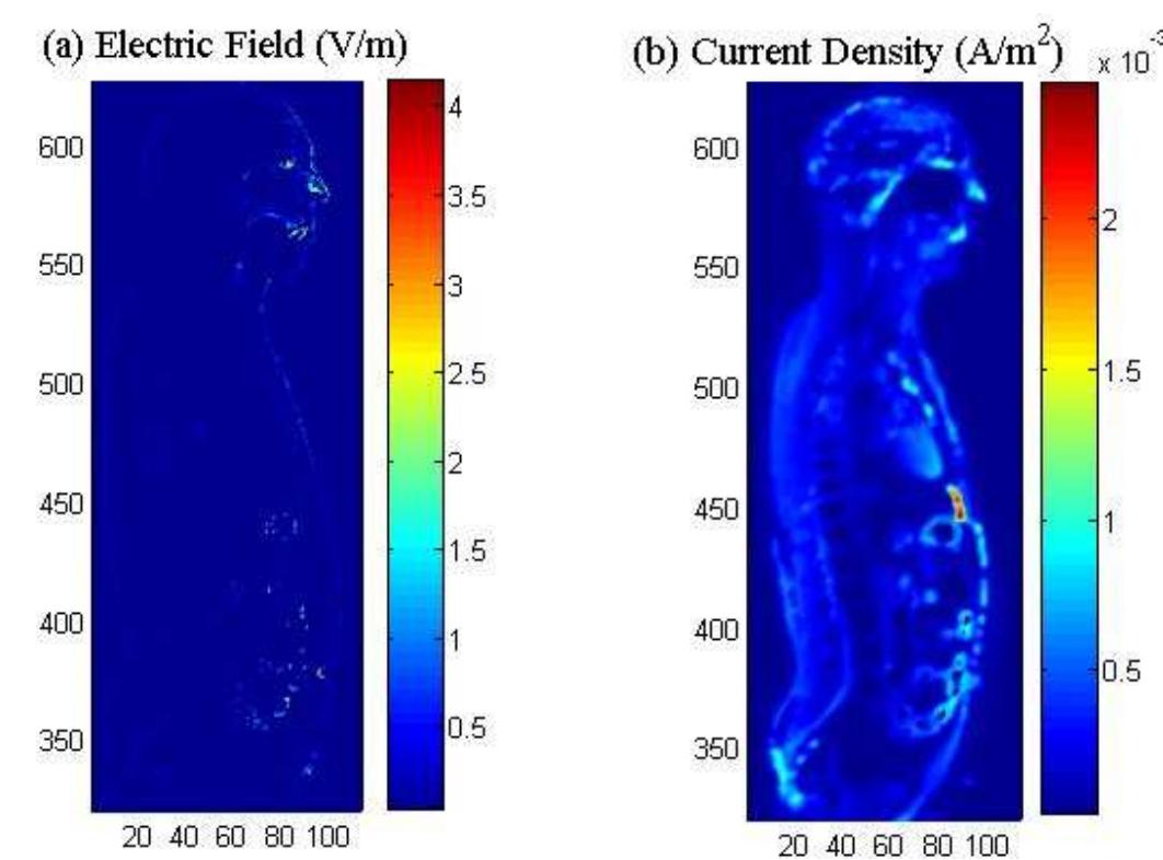 (PDF) Visible Human Utilization to Render Induced Electric Field and ...