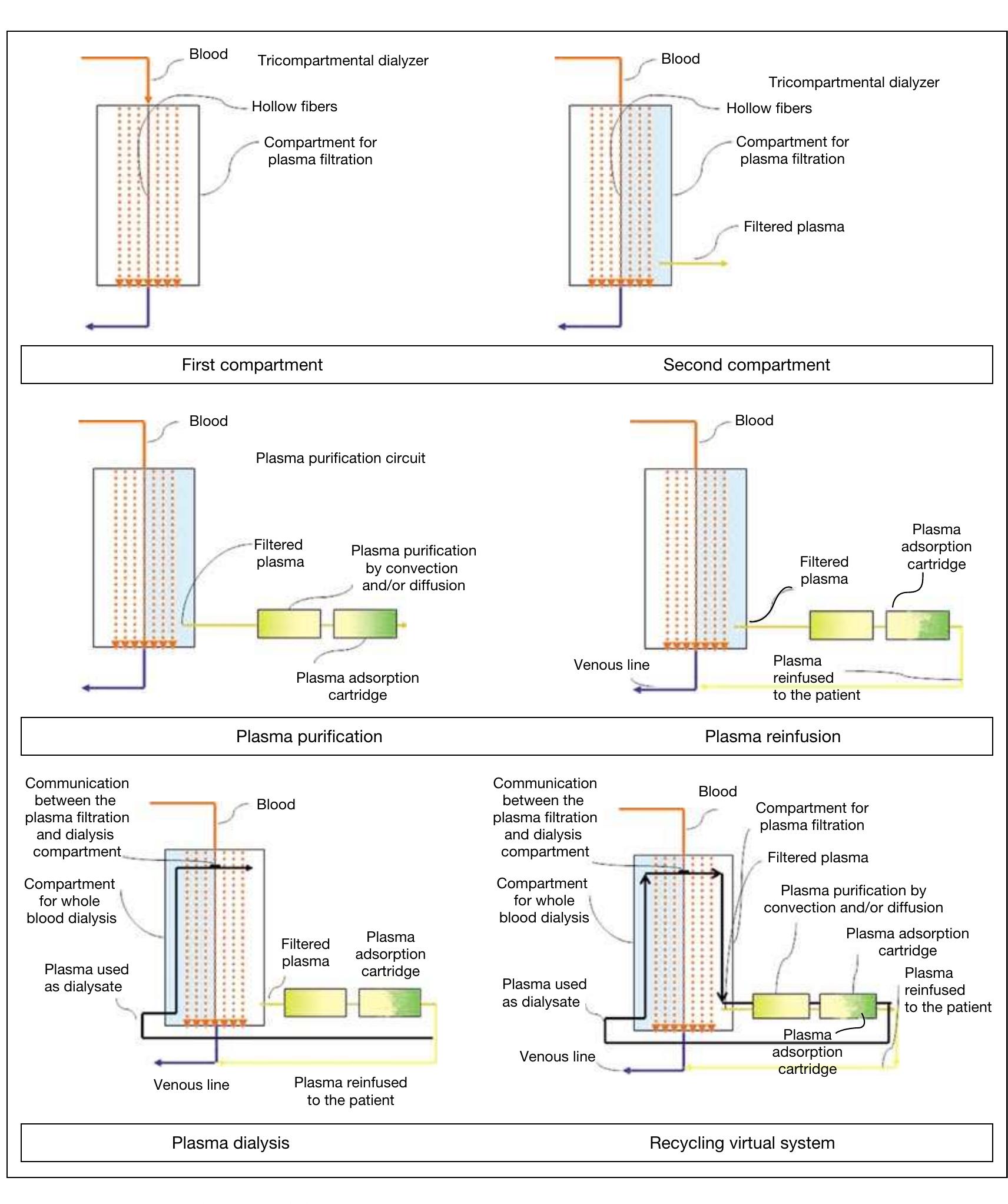 【ramos】 PDF) Coupled Plasma Filtration Adsorption