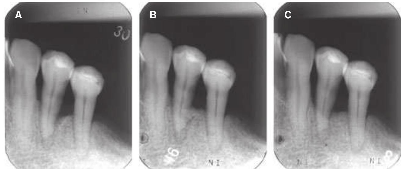 (PDF) Current and future periodontal tissue engineering