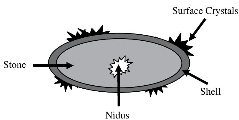 Suture as a foreign object nidus in a struvite urolith from