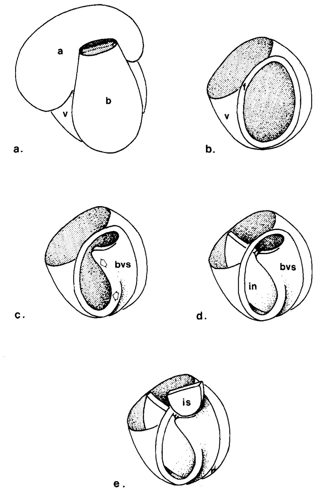 Diagrams to show the different components of the normal