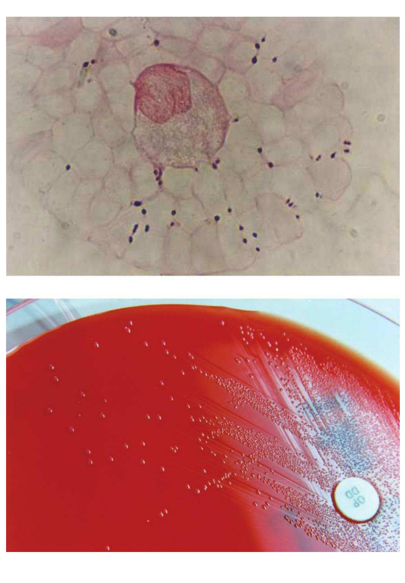 Figure 1 - from Streptococcus suis: An Emerging Human