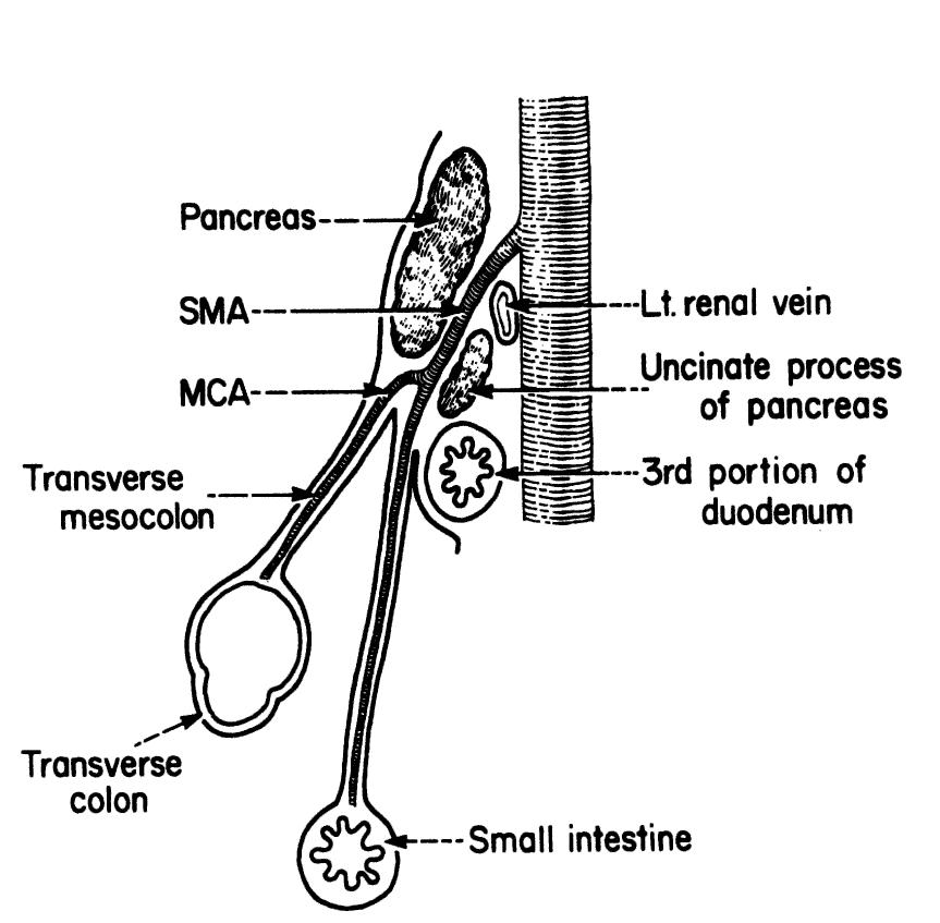 14. diagrammatic sagittal section showing the duodenum be